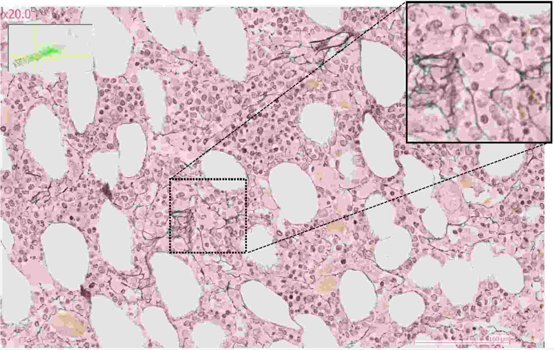 Coupe biopsie équipe Aurrand Lions - Équipe Interactions Leuco/Stromales dans l’hématopoïèse normale et pathologique - CRCM