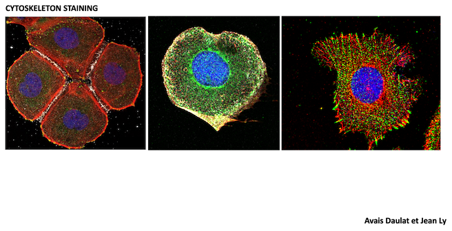 Cytoskelton équipe Ciblage des réseaux et microenvironnement dans le cancer - CRCM