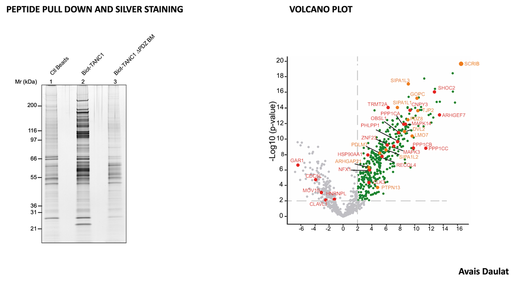 Peptide pull down and volcano plot équipe Ciblage des réseaux et microenvironnement dans le cancer - CRCM