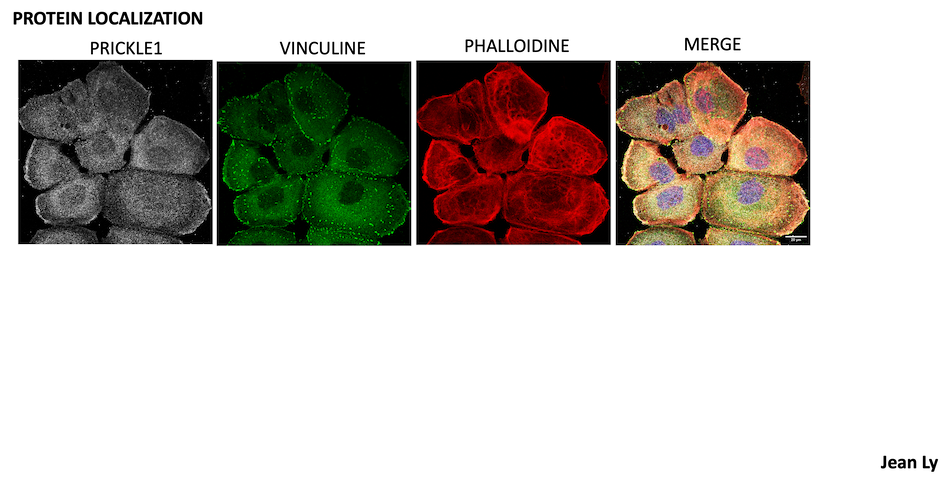 Protein localization équipe Ciblage des réseaux et microenvironnement dans le cancer - CRCM
